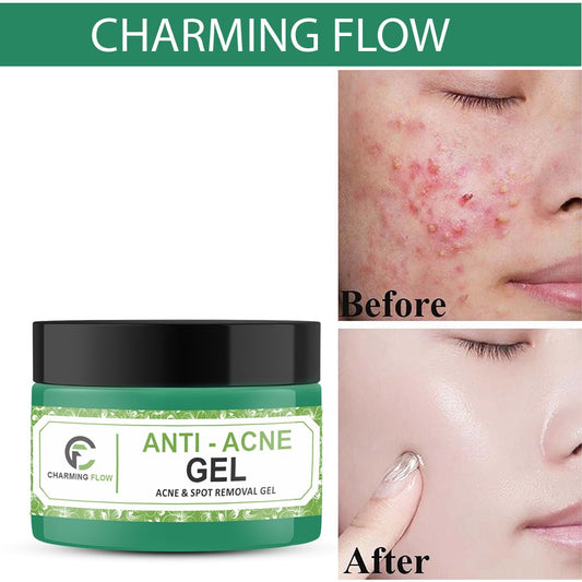 CHARMING FLOW Anti-Acne Gel – Clear, Smooth & Blemish-Free Skin with Niacinamide & Salicylic Acid (50ml)